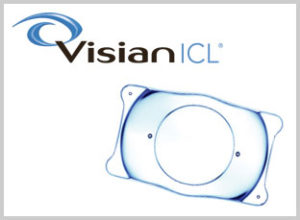 Visian ICL™ - Implantable Collamer Lens Torrance